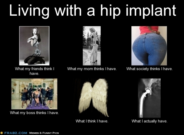 Living with a hip implant